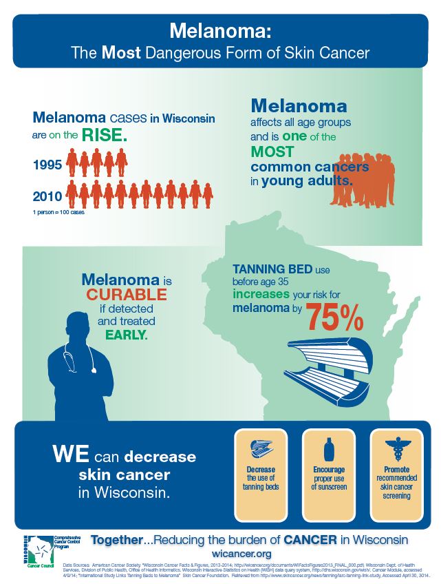 How to Spot Skin Cancer  American Cancer Society